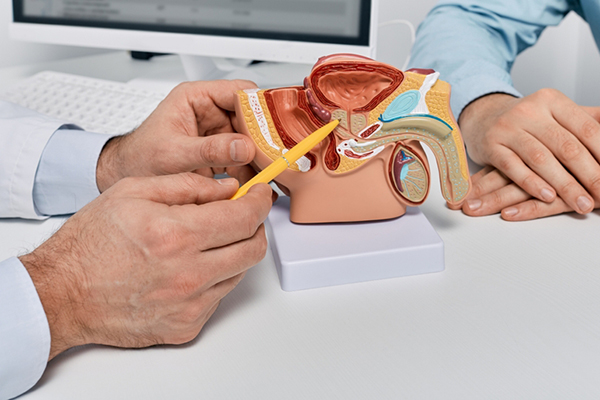 Doctor consulting man patient with suspected prostate cancer using male reproductive system model while visit in urology clinic. Prostate problems and treatment